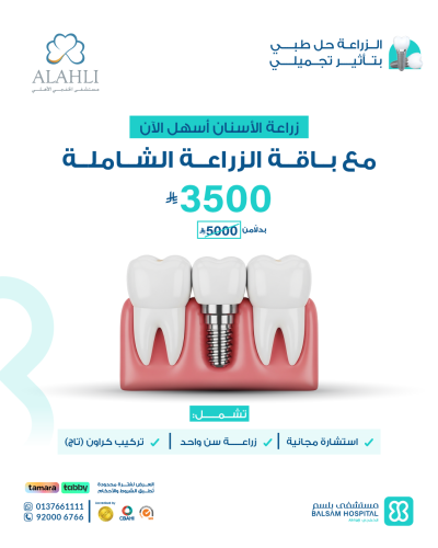 Dental Implants Offer